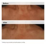 The Ordinary.EmulsionNiacinamide 5% Face and Body Emulsion 100ml - Image 2