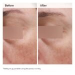 The Ordinary.EmulsionNiacinamide 5% Face and Body Emulsion 100ml - Image 3